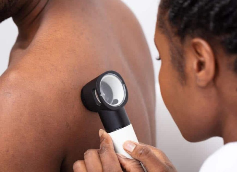 dermatologist canterbury kent